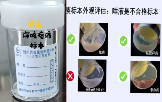 4痰标本.jpg